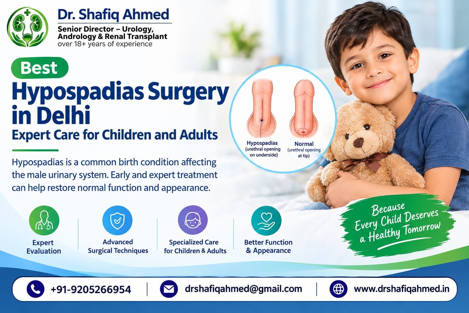 Best Hypospadias Surgery in Delhi