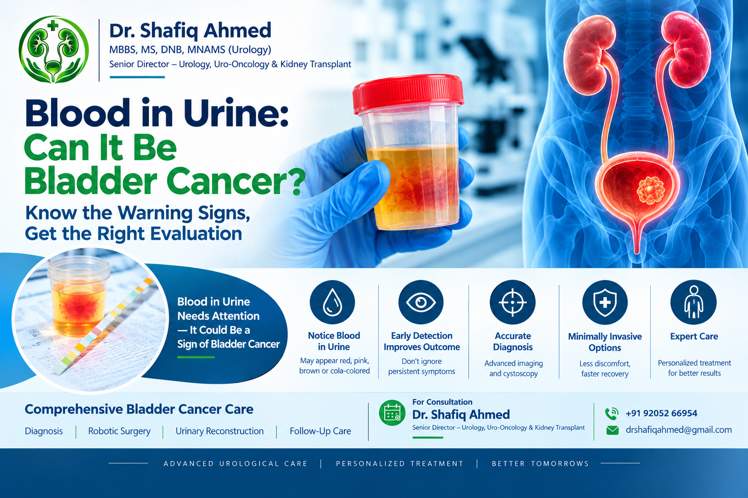 bladder cancer specialist in Delhi